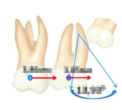 pendulum-appliance1 pendulum-appliance1