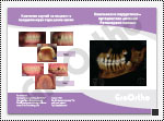 Комплексно хирургично-ортодонтско лечение Ретинирани канини 