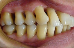 Възрастова ортодонтия